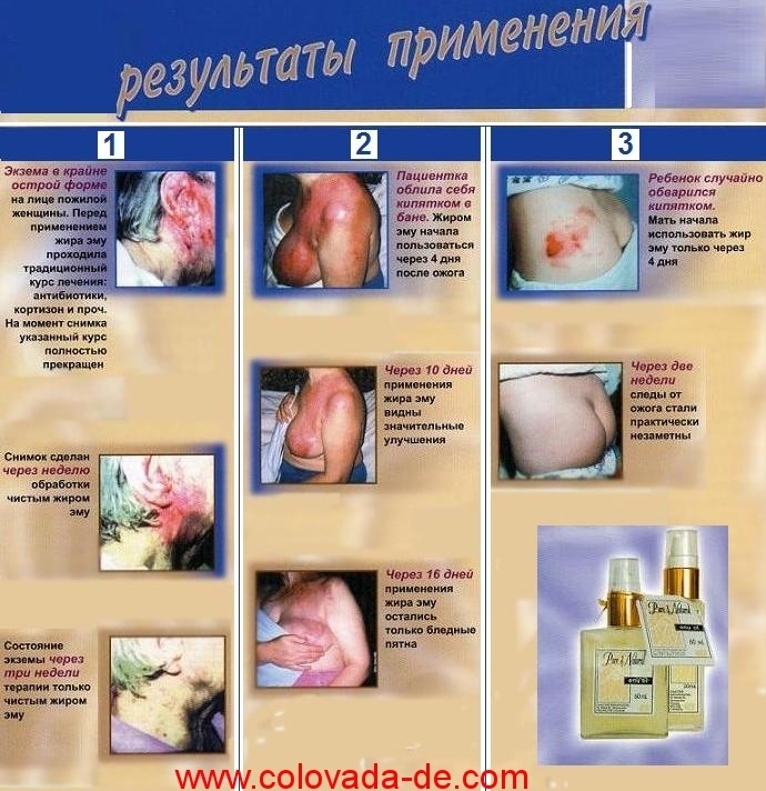 Жир Эму - 3 результата